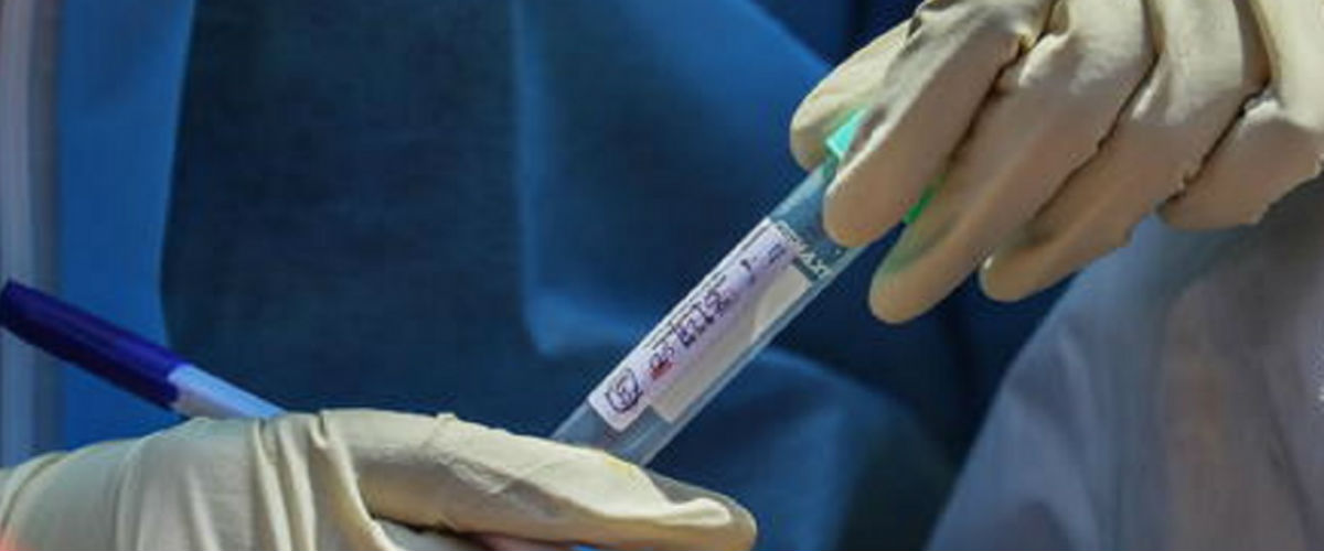 Governo: “I primi di maggio inizieranno i test sierologici”