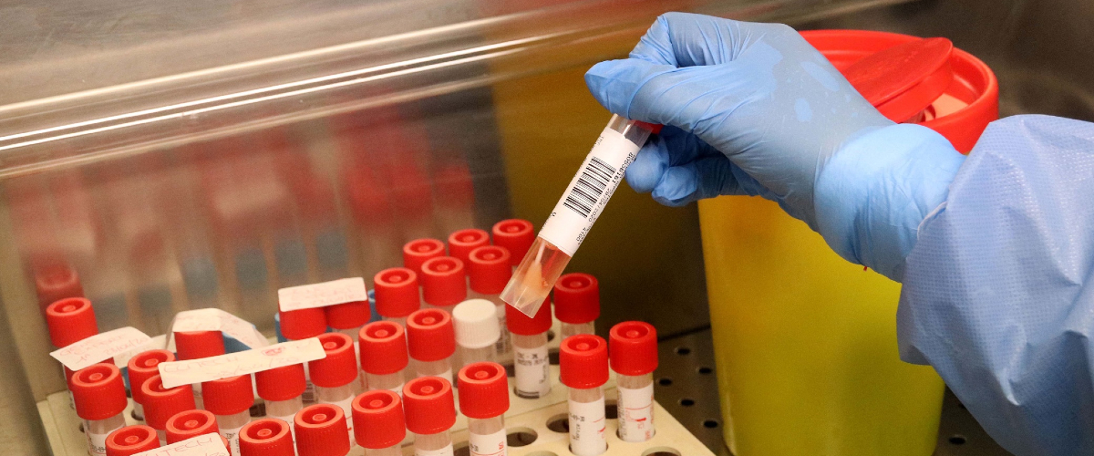 Coronavirus in Italia, il bollettino del 28 novembre: diminuiscono i contagi