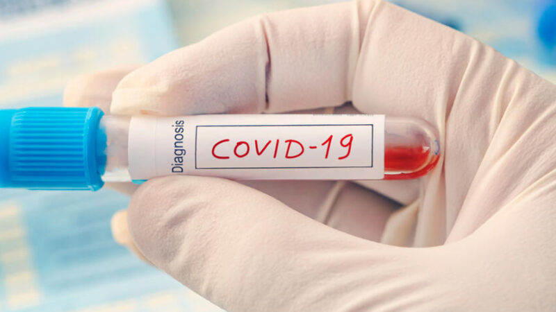 Coronavirus in Italia, il bollettino del 6 novembre: +124 terapie intensive