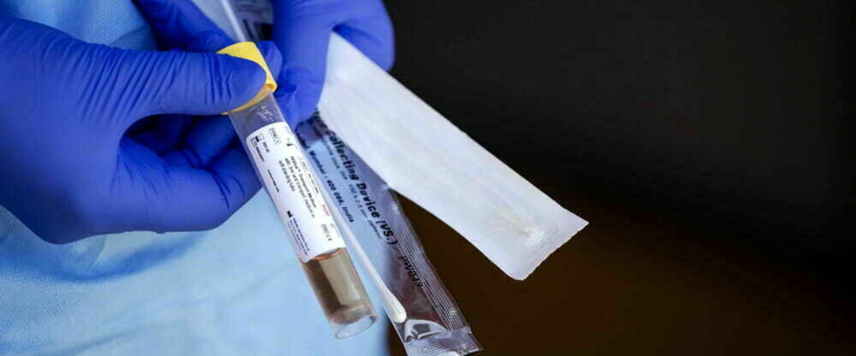 Coronavirus in Italia, il bollettino del 30 novembre: aumentano i ricoveri