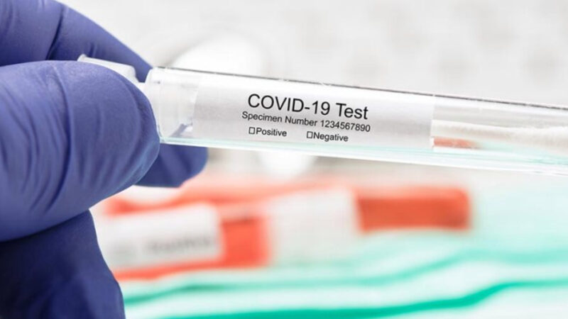 Coronavirus in Italia, il bollettino del 29 novembre: +541 morti per Covid