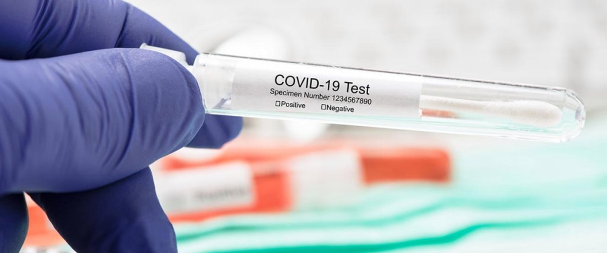 Coronavirus in Italia, il bollettino del 29 novembre: +541 morti per Covid
