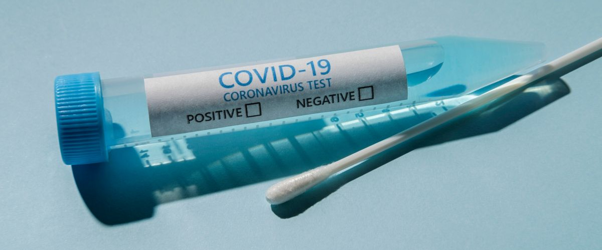 Coronavirus in Italia, il bollettino del 6 dicembre: +564 morti per Covid
