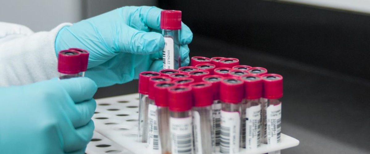 Coronavirus in Italia, il bollettino del 4 dicembre: aumentano i contagi