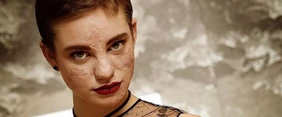 Norme anti – covid: Bebe Vio multata, era al bar con amici dopo le 18