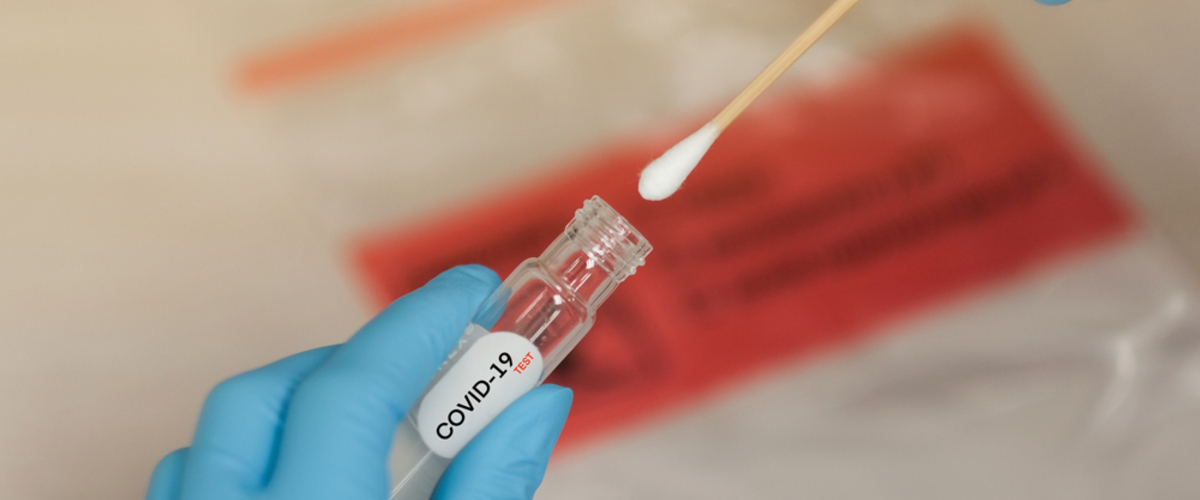 Coronavirus in Italia, il bollettino del 19 dicembre: -405 ricoveri