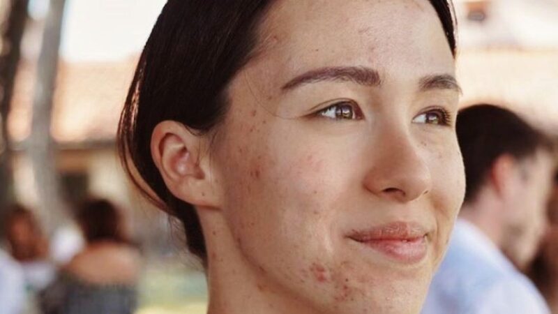 Addio pelle impura e acne: la Teen Beauty degli esperti AIDECO per i ragazzi