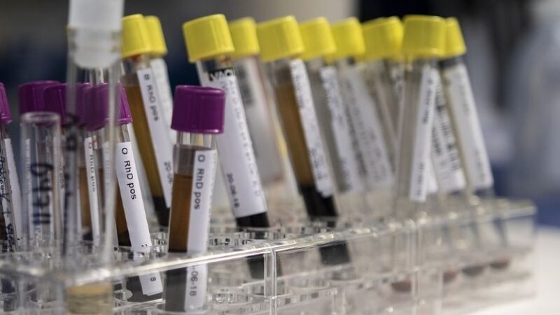 Coronavirus in Italia, il bollettino del 7 marzo: tasso di positività al 7,6%