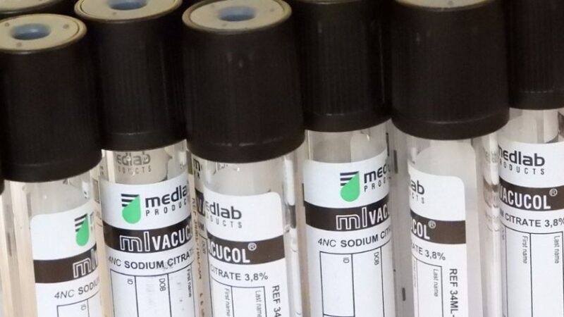 Coronavirus in Italia, il bollettino del 9 marzo: 19.749 nuovi casi