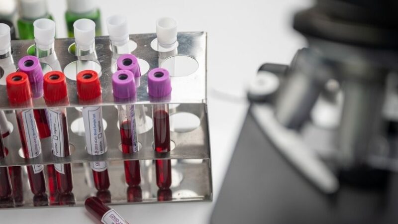 Coronavirus in Italia, il bollettino del 12 marzo: 26.824 nuovi casi