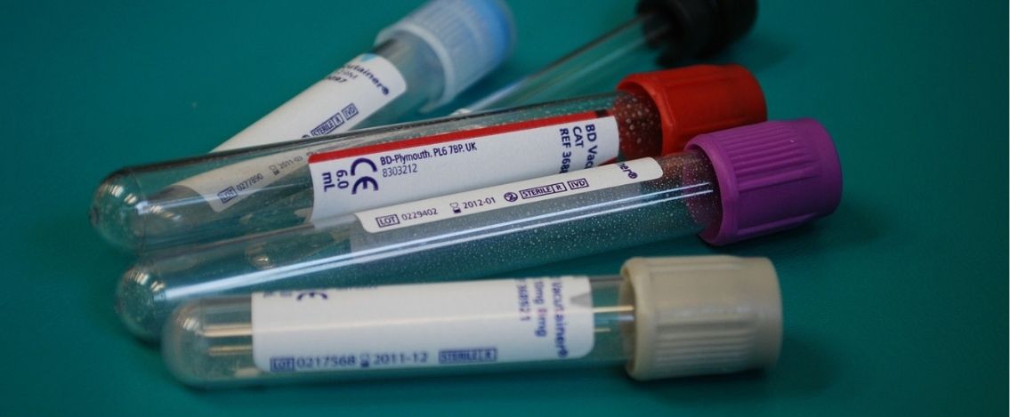 Coronavirus in Italia, il bollettino del 16 marzo: 502 vittime