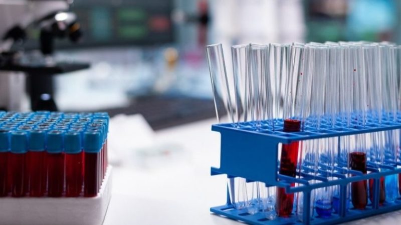 Covid, uno studio italiano ha scoperto la “porta d’ingresso” del virus