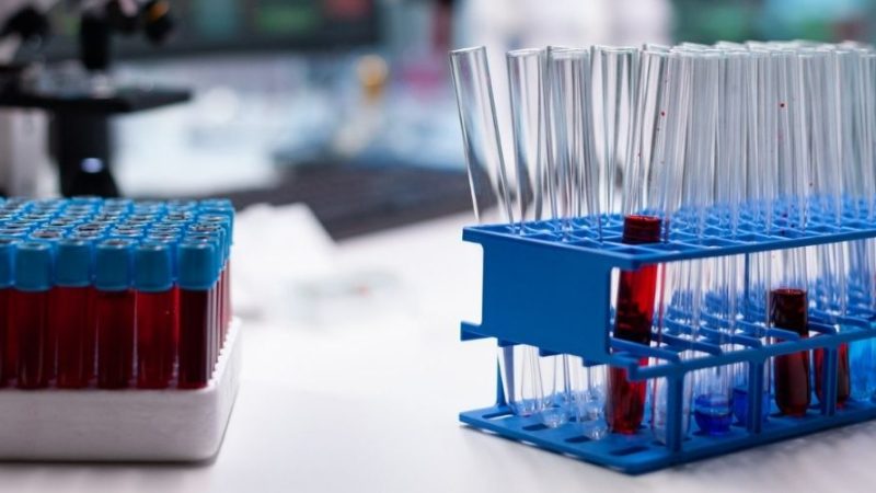 Variante Omicron, cosa dobbiamo aspettarci