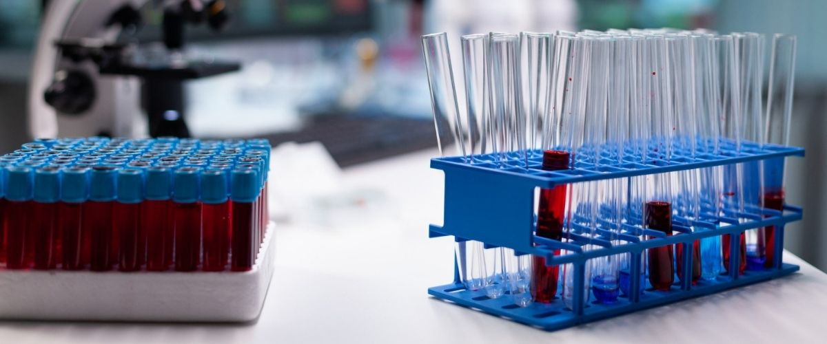 Variante Omicron, cosa dobbiamo aspettarci