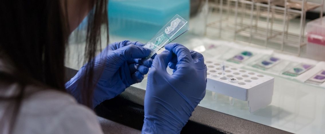 Crescita variante Omicron, si va verso i 400mila casi