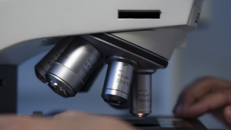 Vaiolo delle scimmie, il virus è stato isolato al Sacco di Milano