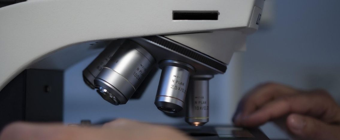 Vaiolo delle scimmie, il virus è stato isolato al Sacco di Milano