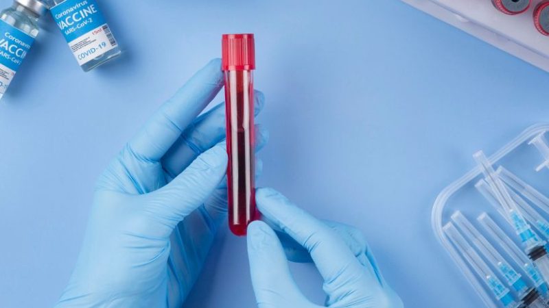 Vaiolo delle scimmie. L’Oms avverte sul pericolo contagio in estate