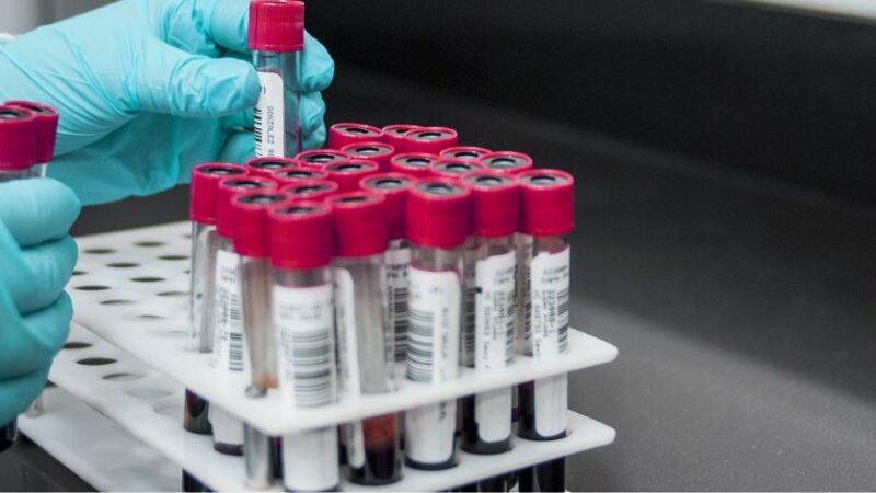 L’Oms sul Vaiolo delle Scimmie: “In UE l’epidemia sta calando”
